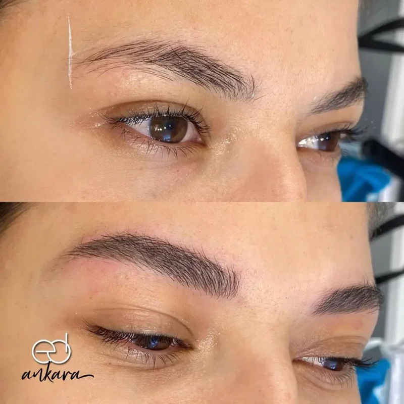 microblading-oncesi-sonrasi-1-emsal-dogan-ankara (1)